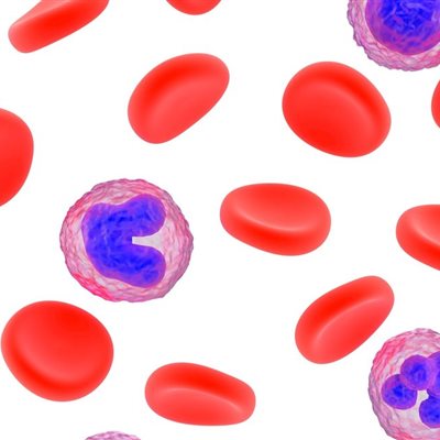 Un análisis de sangre podría diagnosticar de forma precoz el cáncer de páncreas