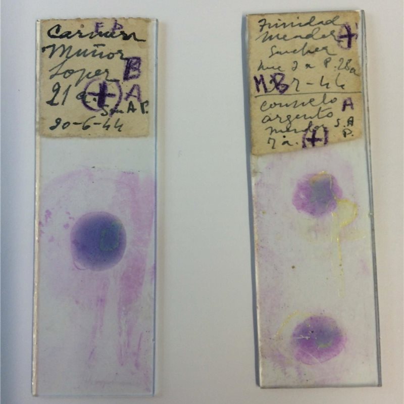 Unas muestras de sangre revelan cómo era la malaria en la primera mitad del siglo XX