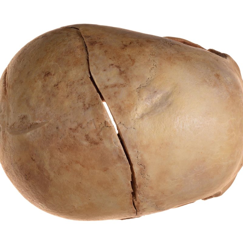 Un cráneo hallado en Israel es "la evidencia más antigua de una venganza de sangre"