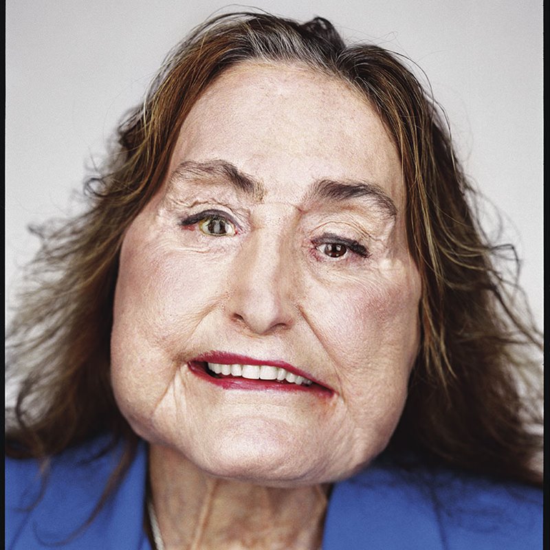Connie Culp, el primer trasplante de cara de EEUU