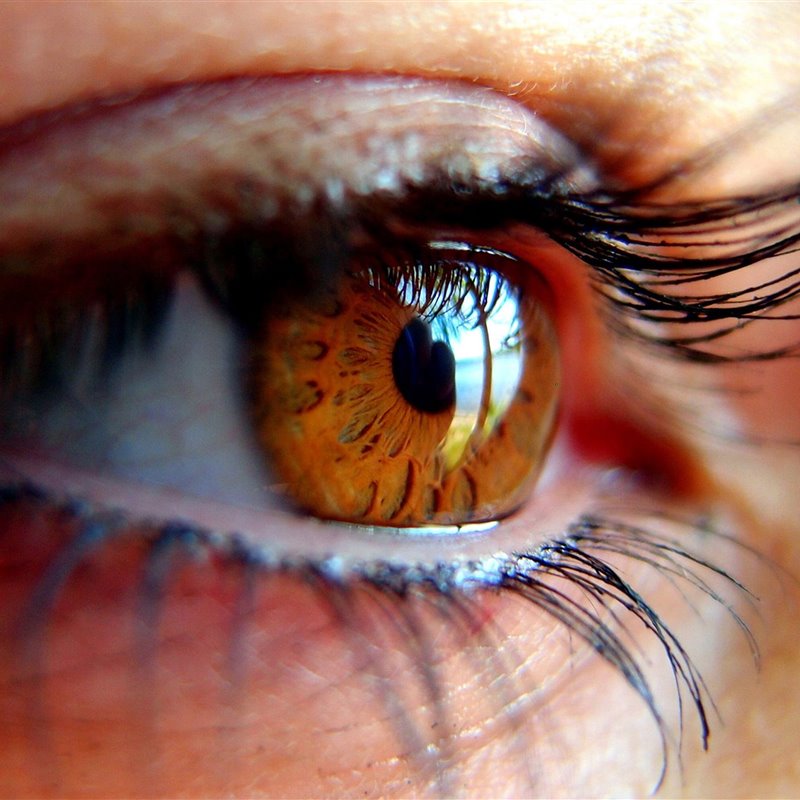 Glaucoma, el ladrón silencioso de la vista