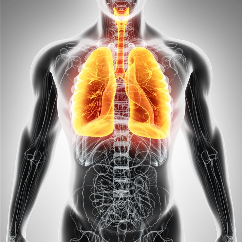 Inteligencia Artificial contra el cáncer de pulmón