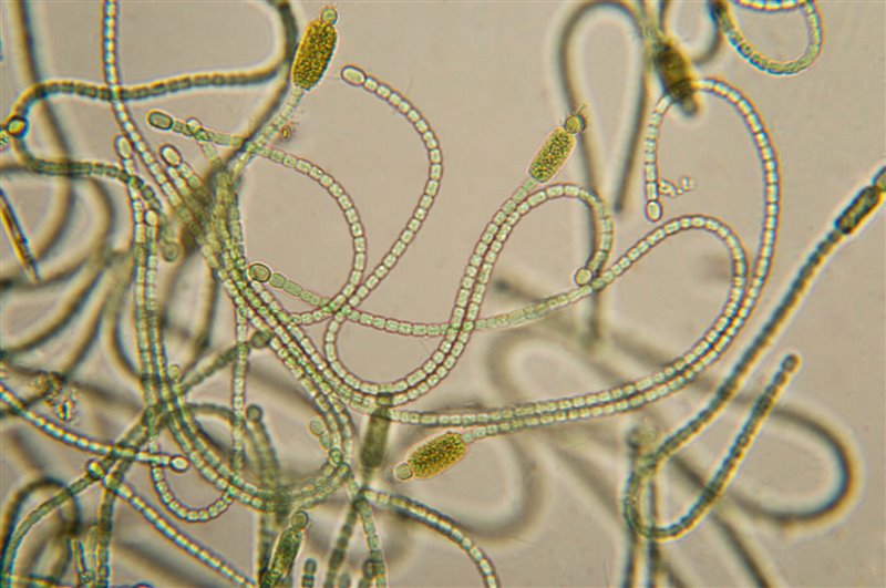 Cianobacterias vistas al microscopio