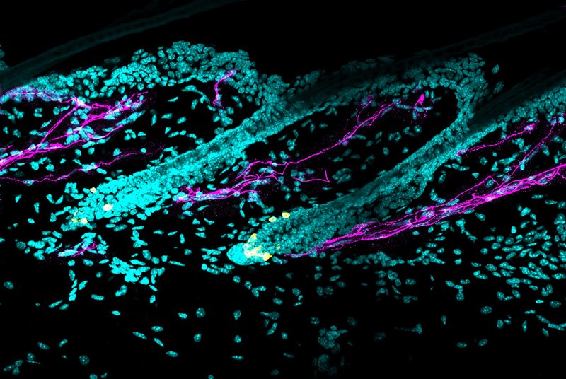 ¿por Qué El Estrés Produce Canas Esto Es Lo Que Dice La Ciencia