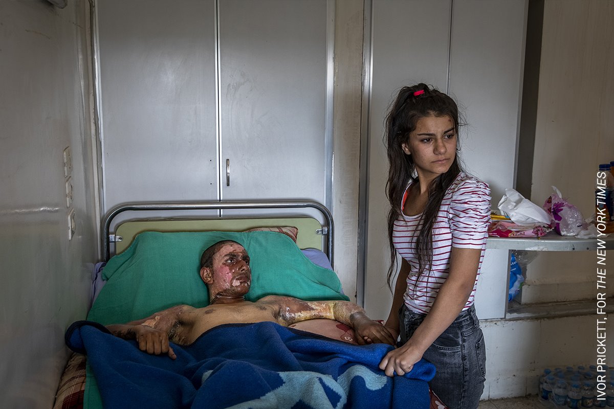 (Injured Kurdish Fighter Receives Hospital Visit) Luchador kurdo herido recibe visita en el hospital