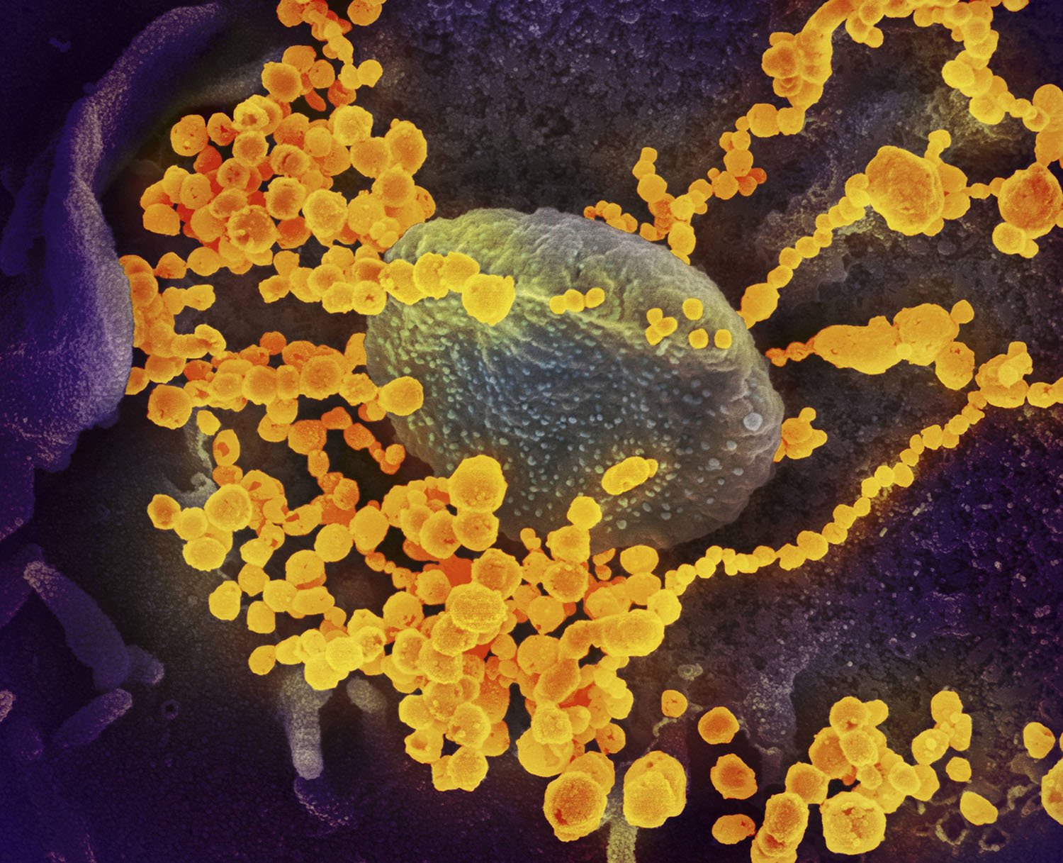 Células humanas rodeadas de virus