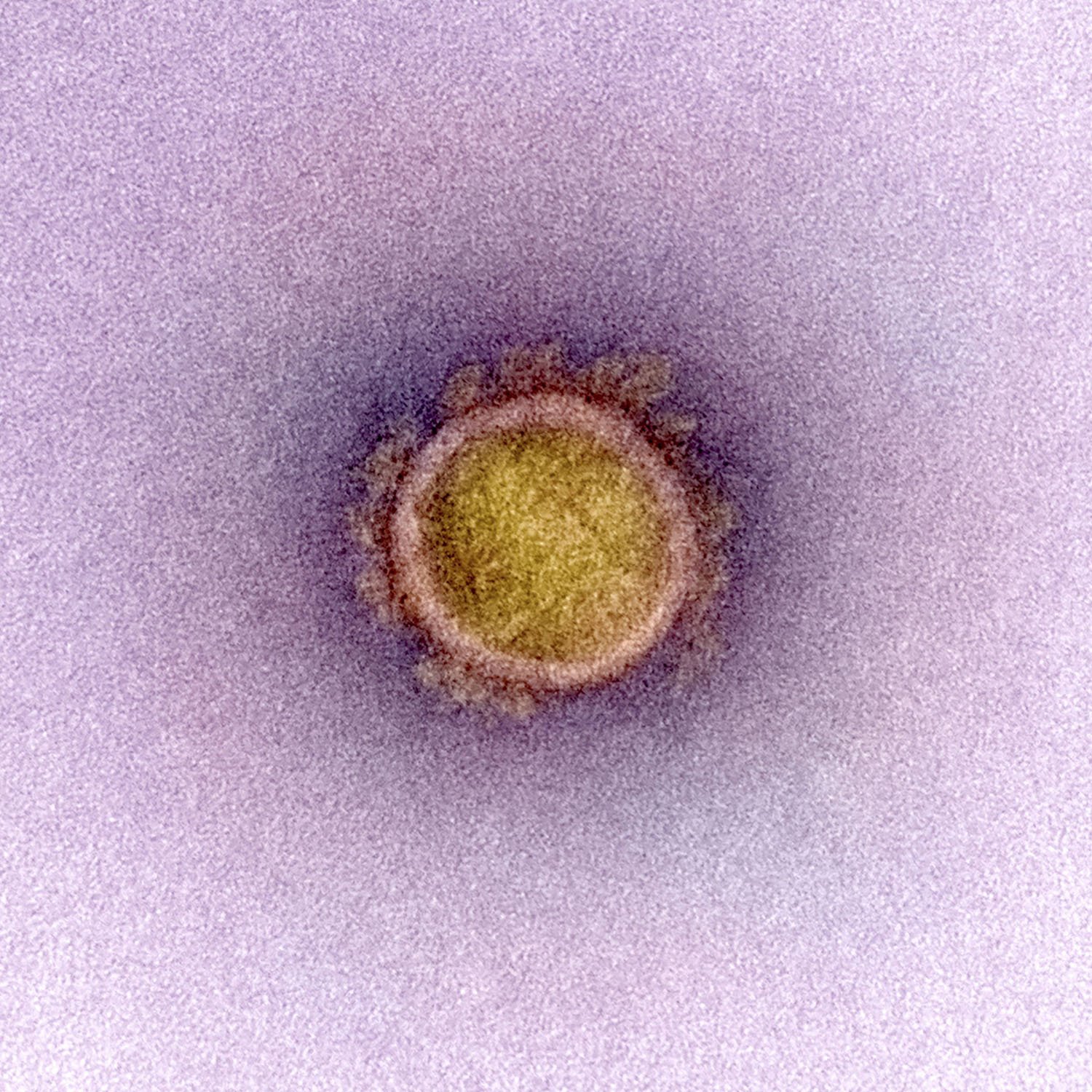 Coronavirus SARS-CoV-2 causante del Covid-19