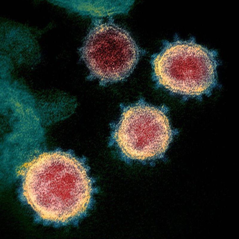 Hasta cuatro coronavirus se distinguen en esta imagen coloreada tomada de una muestra de un paciente estadounidense el pasado 12 de febrero.