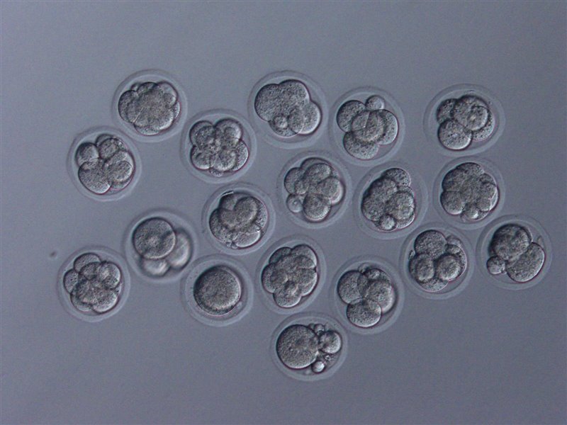 Cultivo de embriones de buena calidad en la Tierra derivados de los espermatozoides liofilizados