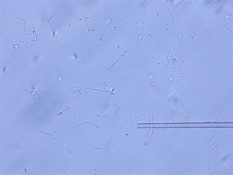 Espermatozoides liofilizados rehidratados con agua y funcionales para la fecundación in vitro