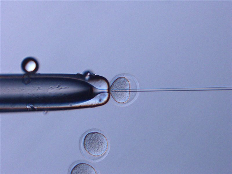 Inyección de espermatozoides espaciales en ovocitos