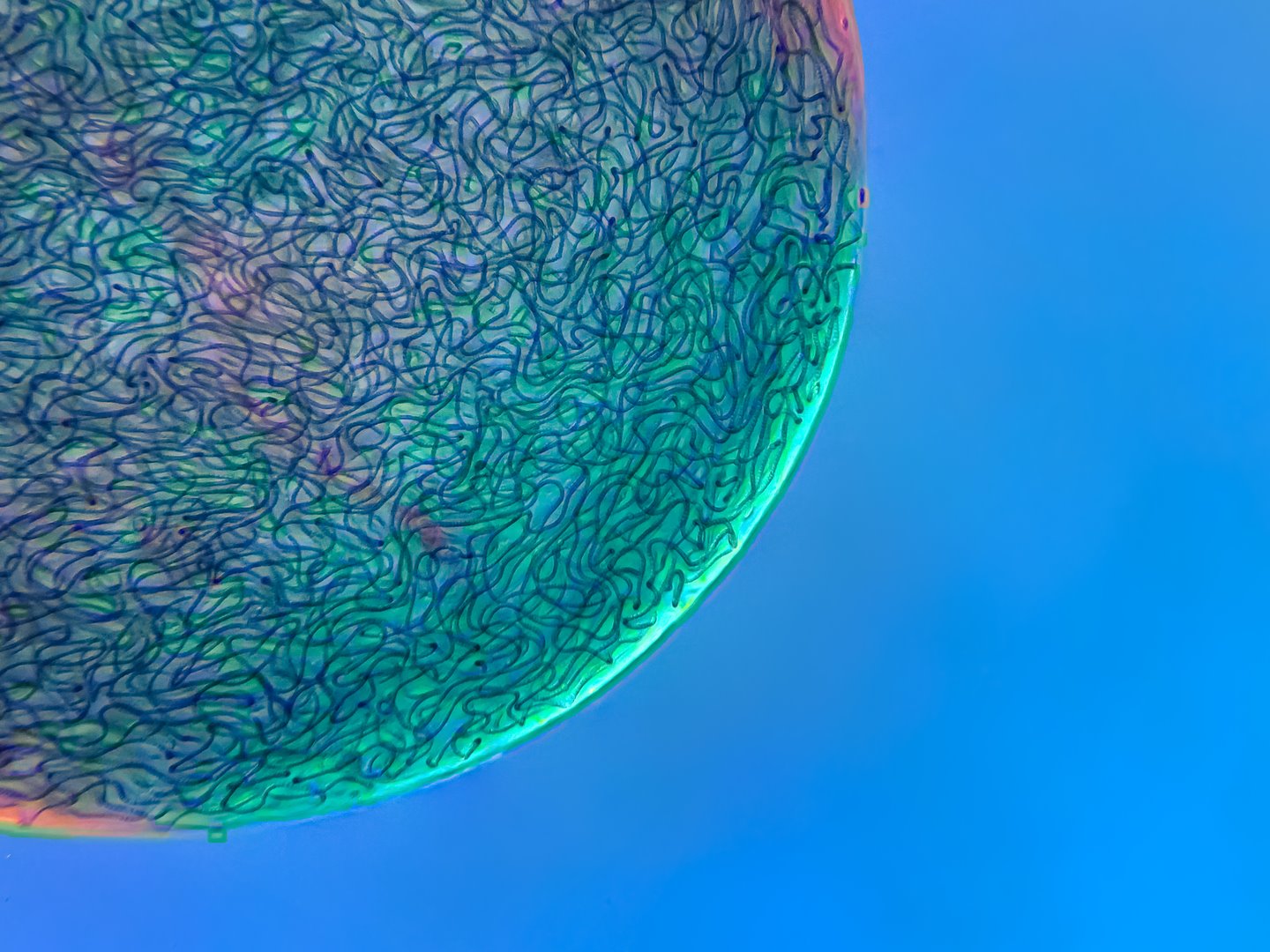 Hebras filamentosas de cianobacterias Nostoc capturadas dentro de una matriz gelatinosa