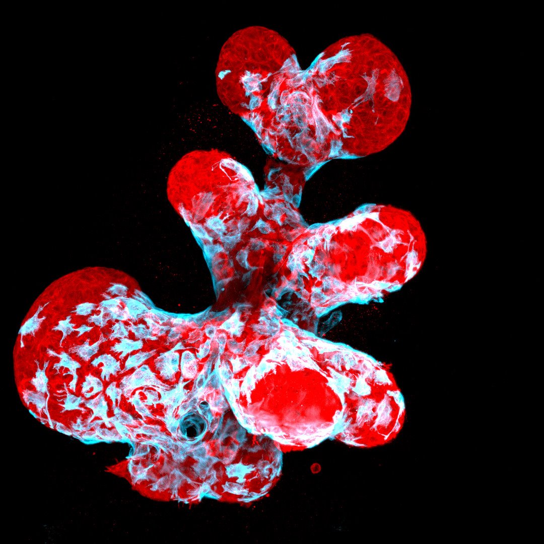 Organoide mamario que muestra células mioepiteliales contráctiles (azul) arrastrándose sobre células mamarias secretoras (rojo)