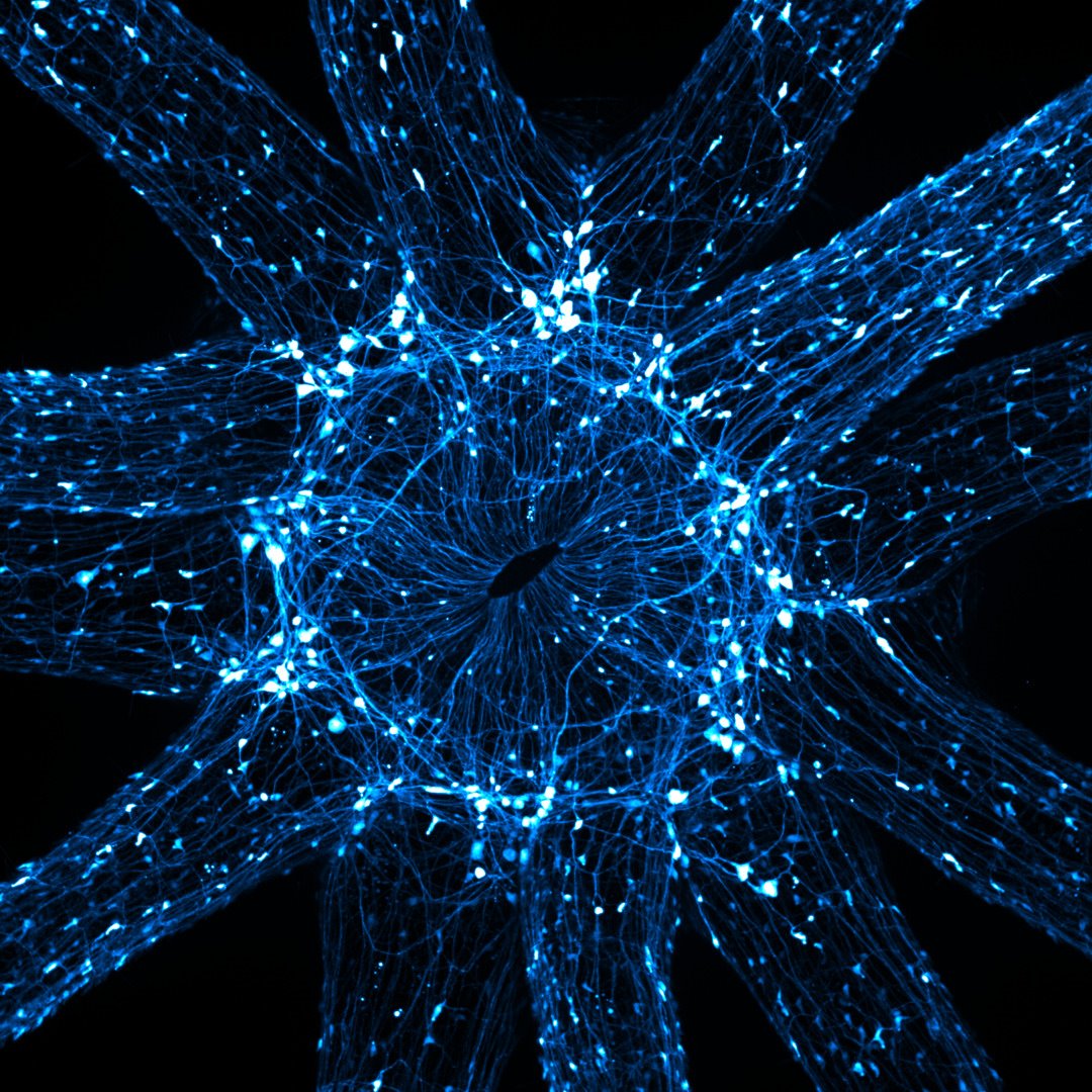 Una instantánea in vivo de las neuronas que rodean la boca y los tentáculos de una anémona de mar estrellada juvenil (Nematostella vectensis)
