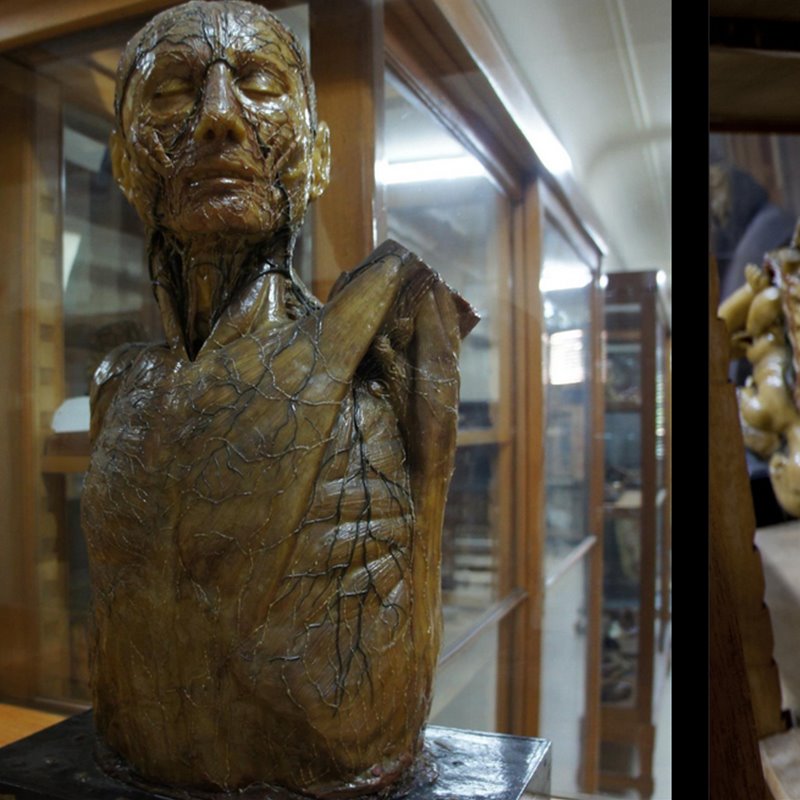 Madrid secreto: el Museo Anatómico de la Universidad Complutense nos abre de nuevo sus puertas
