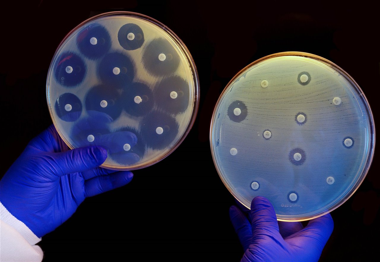 Cultivo de bacterias en dos placas con antibióticos