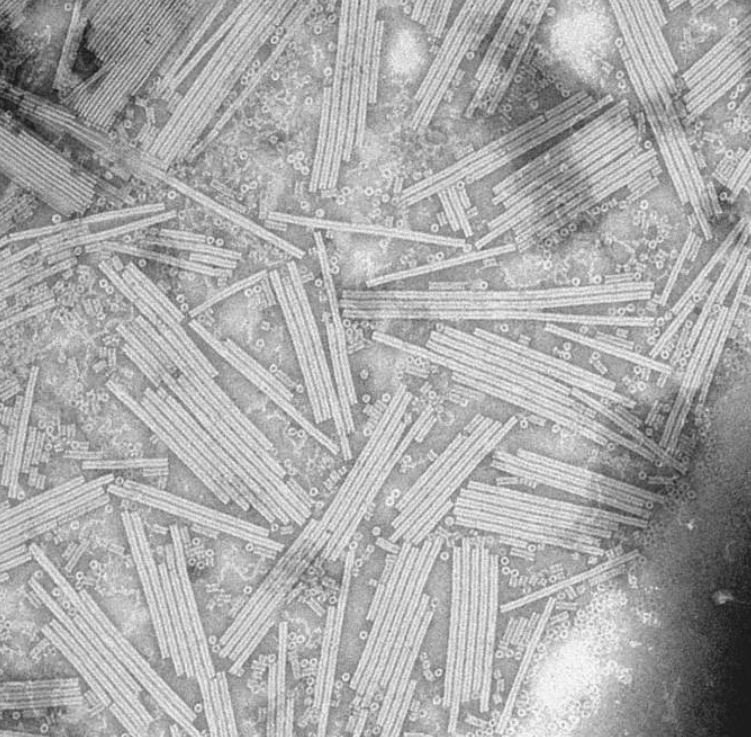 Micrografía electrónica del virus del mosaico del tabaco