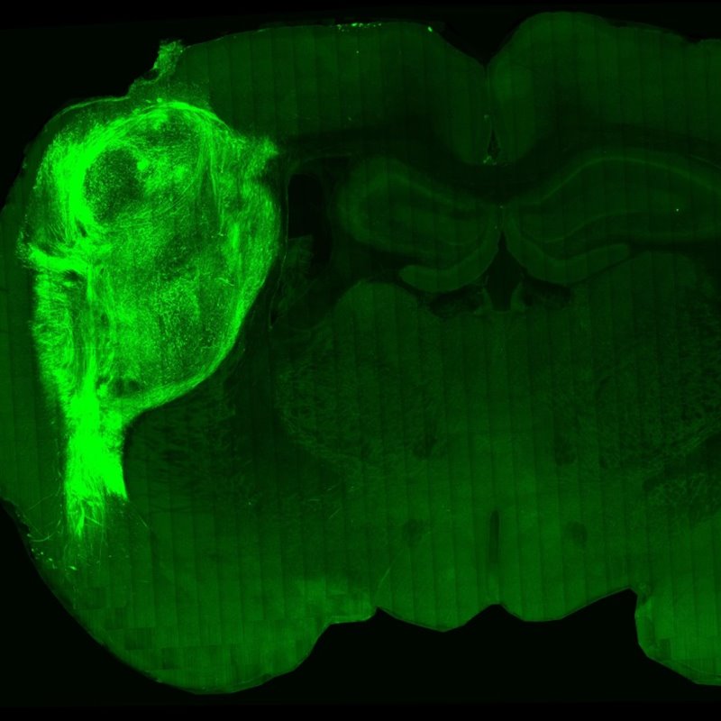 Implantan con éxito neuronas humanas en el cerebro de ratas recién nacidas
