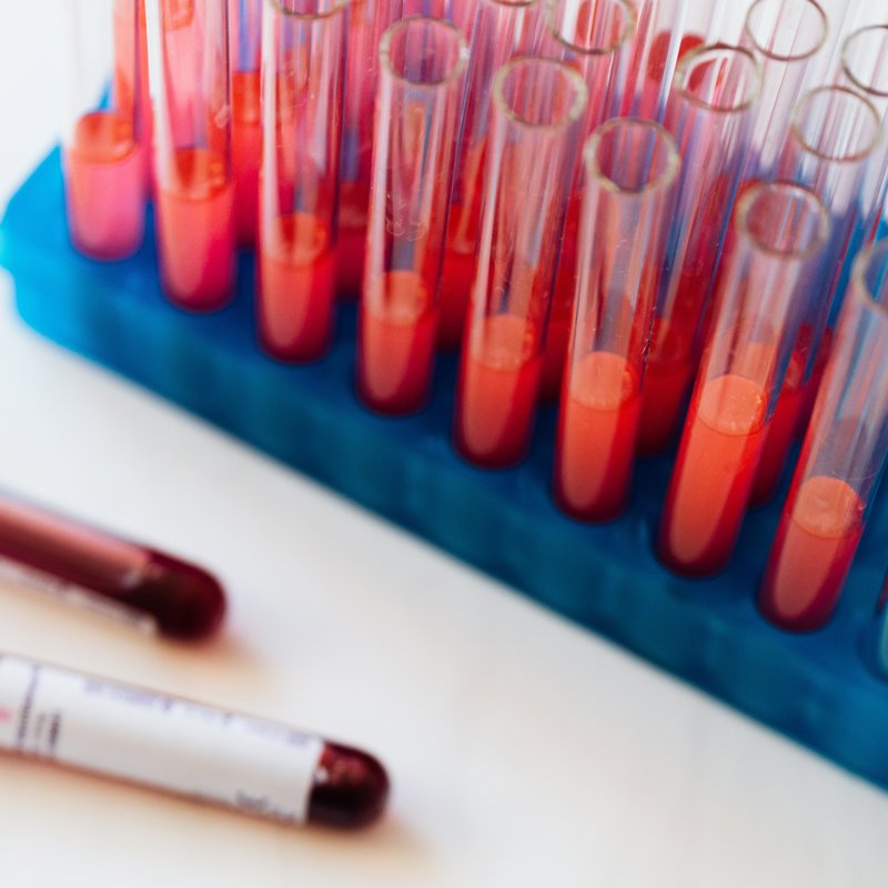Un nuevo test para detectar el cáncer de próstata