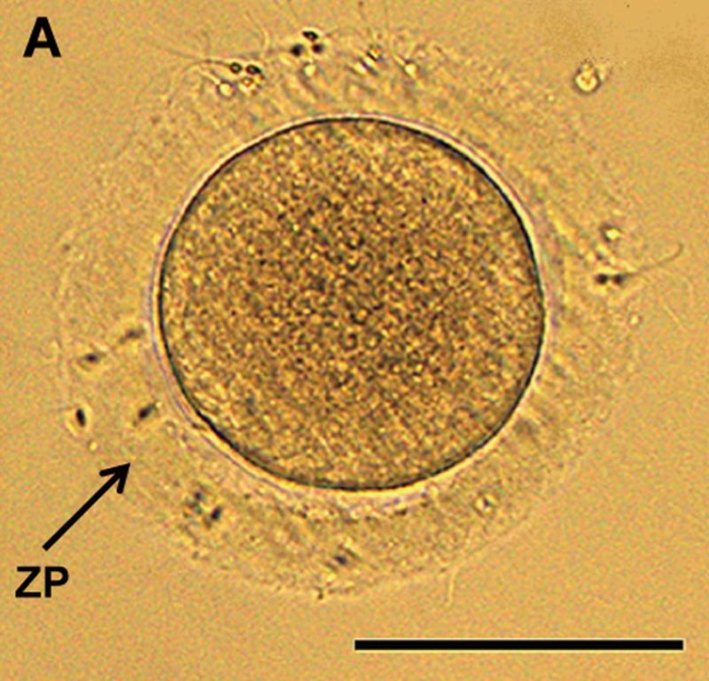 Zona pelucida 