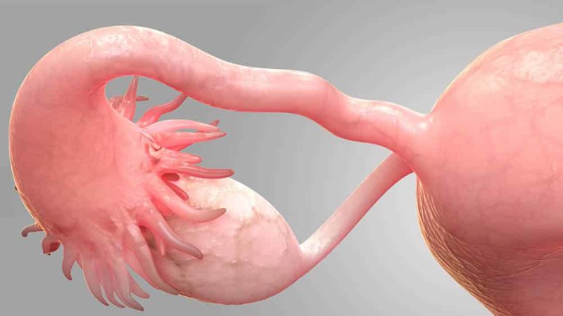 Ilustración representativa de las fimbrias uterinas