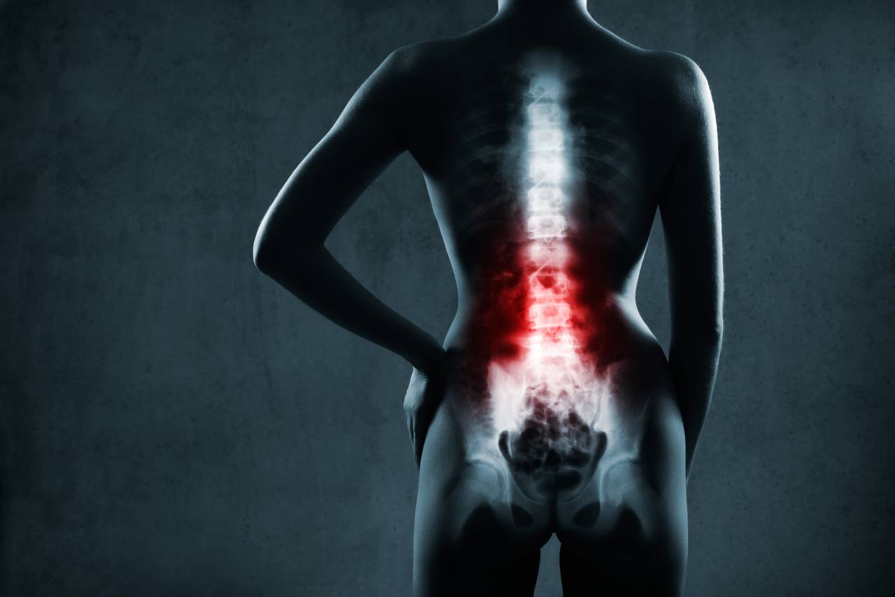 Dolor de espalda: las tres causas principales 