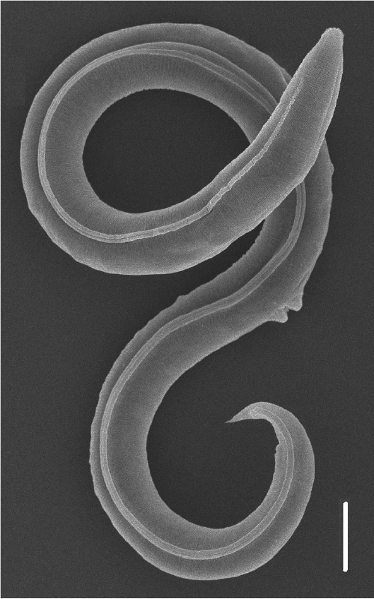 gusanos nematodos en humanos