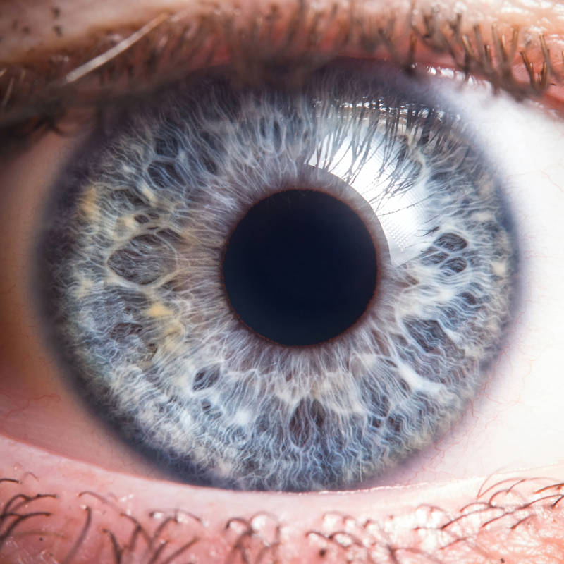 Síndrome de Alejandría: la extraña mutación que daría un color de ojos violeta a ciertas mujeres