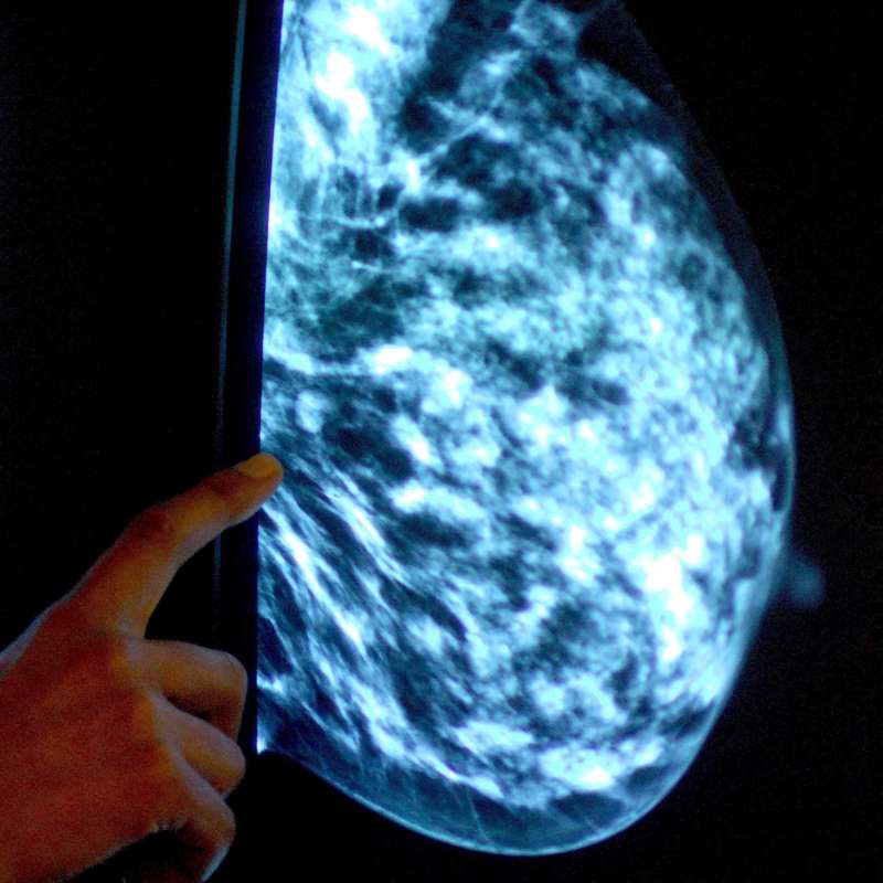 Revolución en la detección temprana del cáncer de mama gracias a un test de saliva