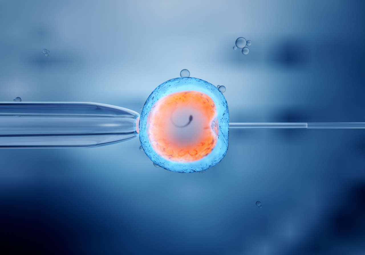 Fecundación in vitro de un óvulo