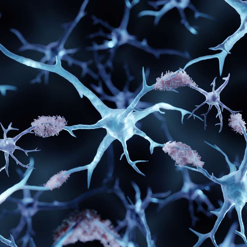 El alzhéimer no es contagioso, pero ahora hay indicios de posible transmisión 