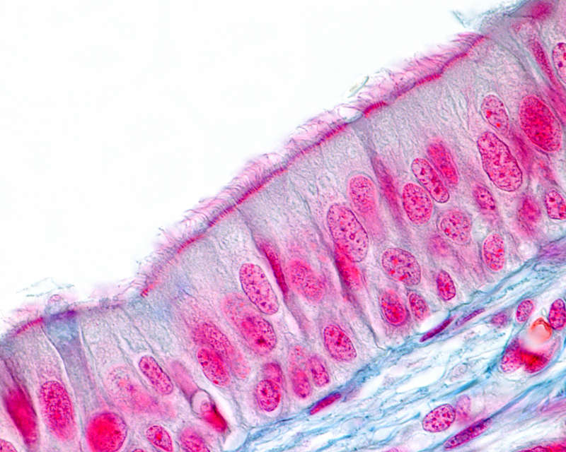 ciliated epithelium