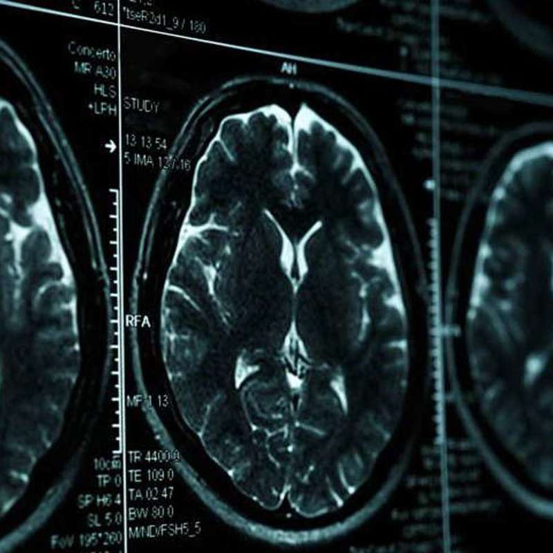 ¿Cuál es el ser vivo con el cerebro más grande del mundo?