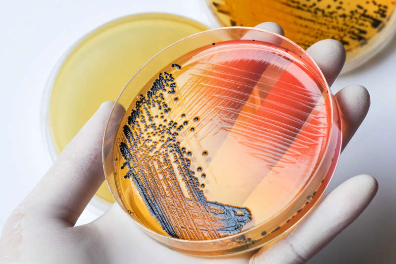 Bacterial culture in the laboratory