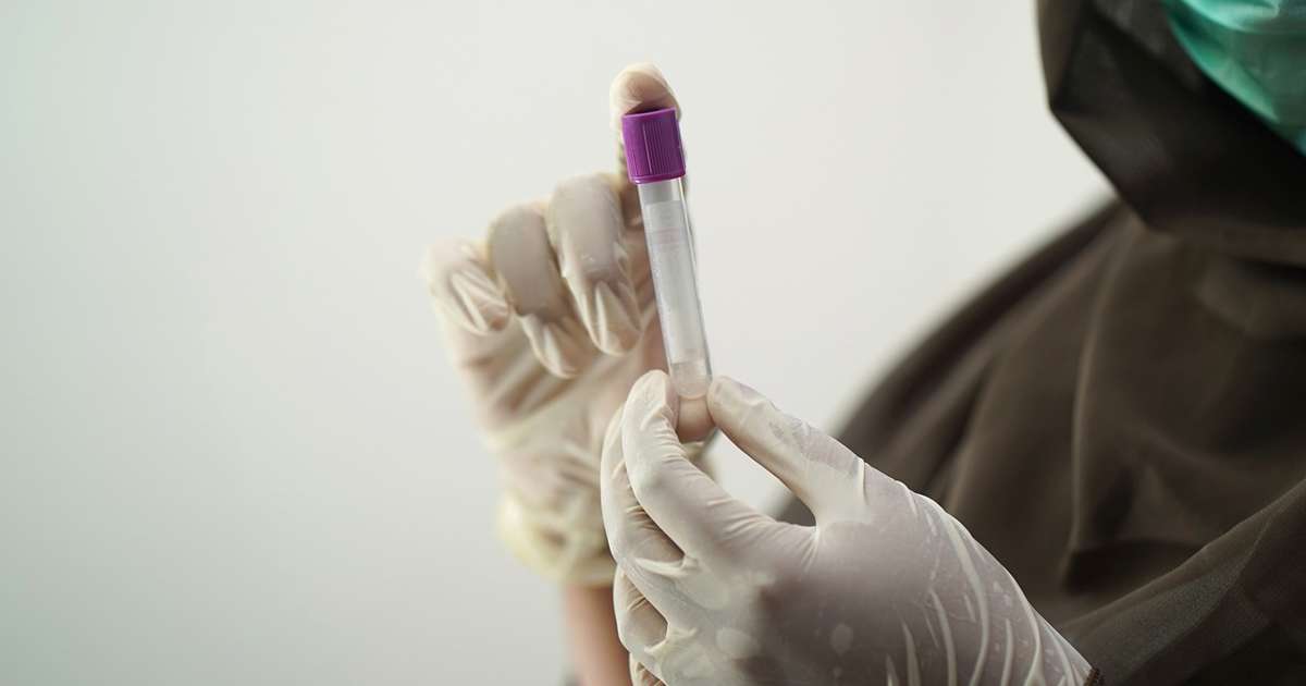 New blood test detects Alzheimer’s more accurately than doctors