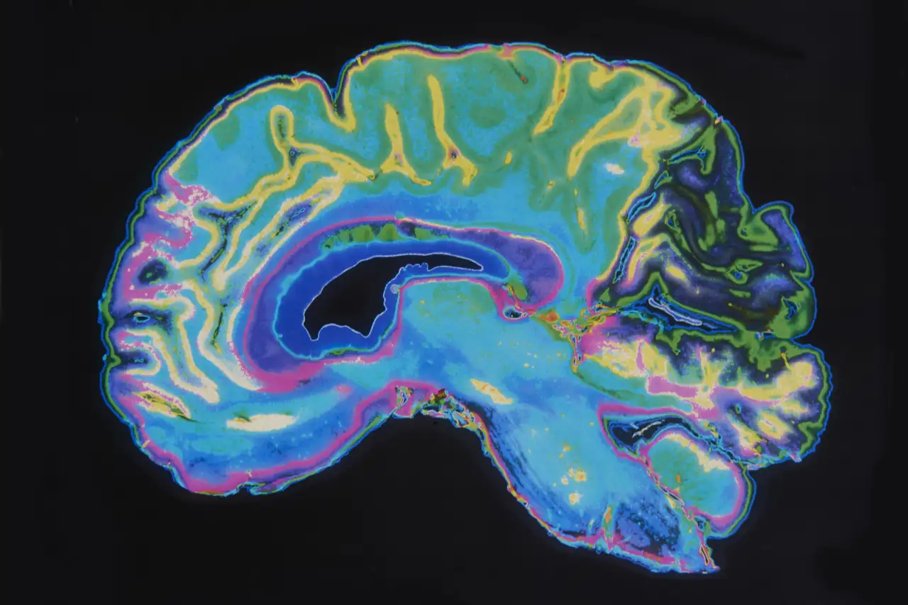 cerebro