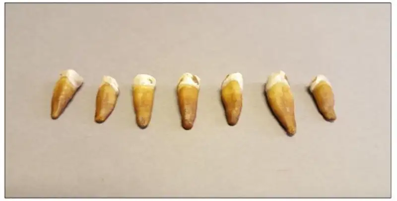 Seven well man teeth recovered from excavation 
