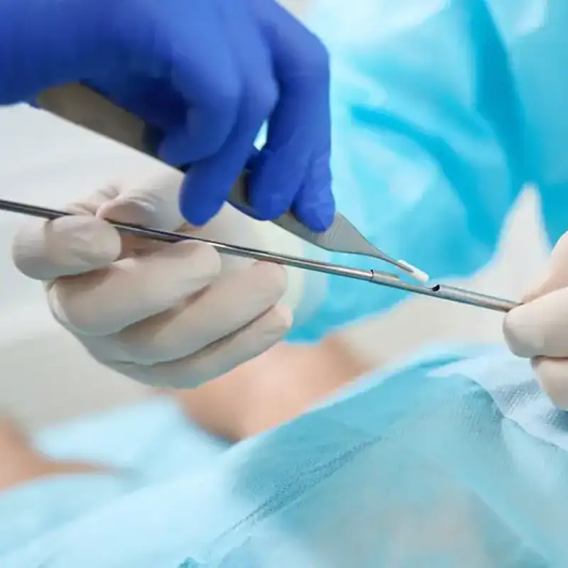 Pellets hormonales: riesgos y ventajas de alargar la juventud