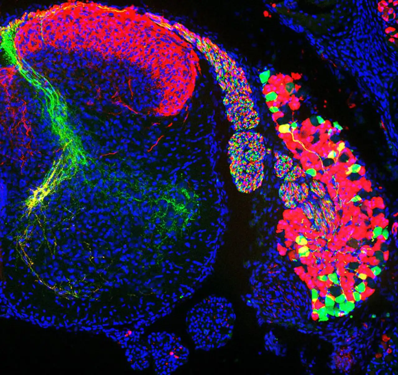 Neuronas sensoriales en la médula espinal. 