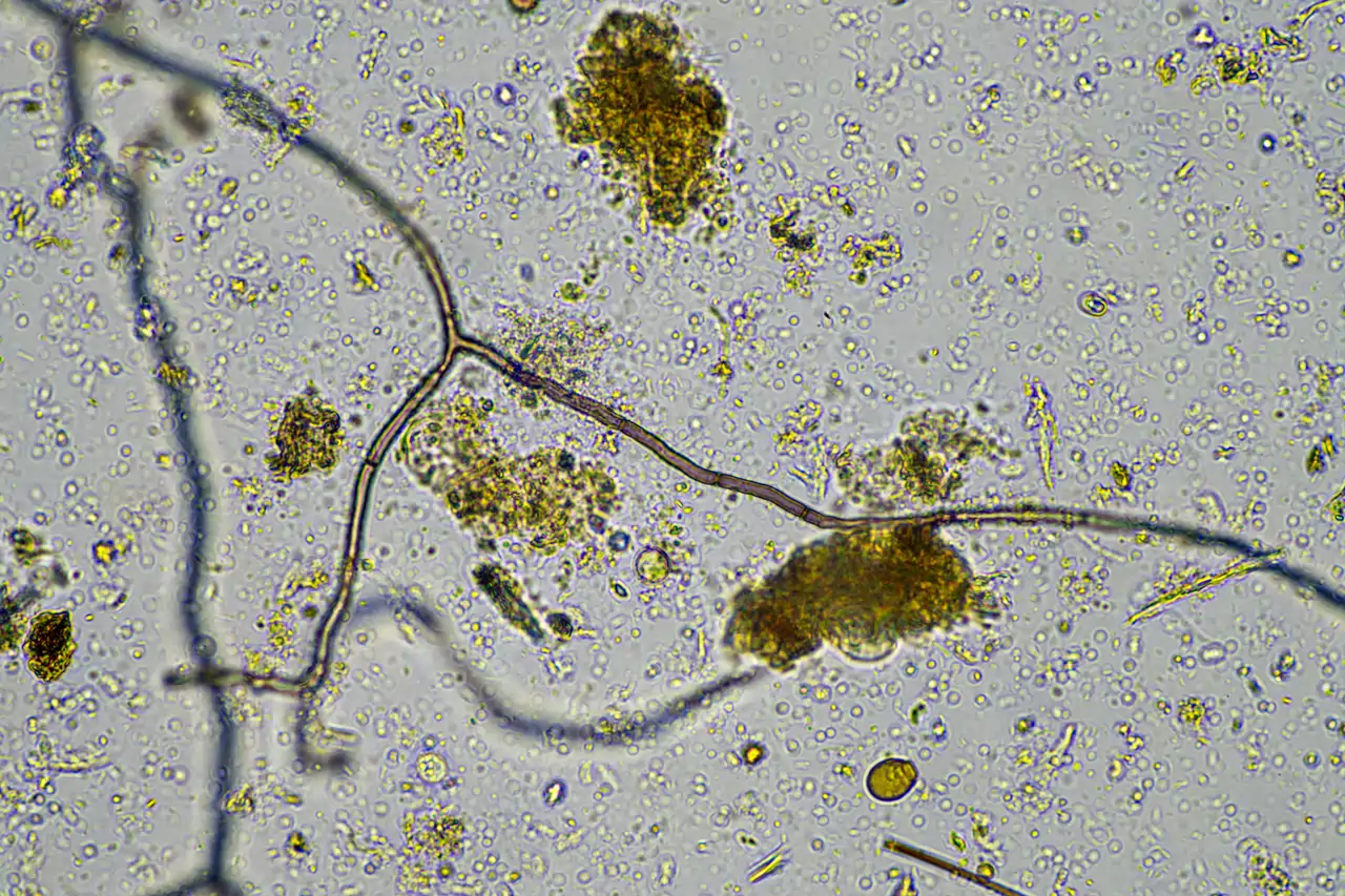 Microbios