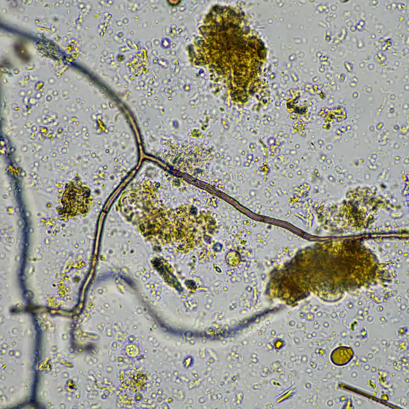 Los microbios que esconden nuestros cepillos de dientes
