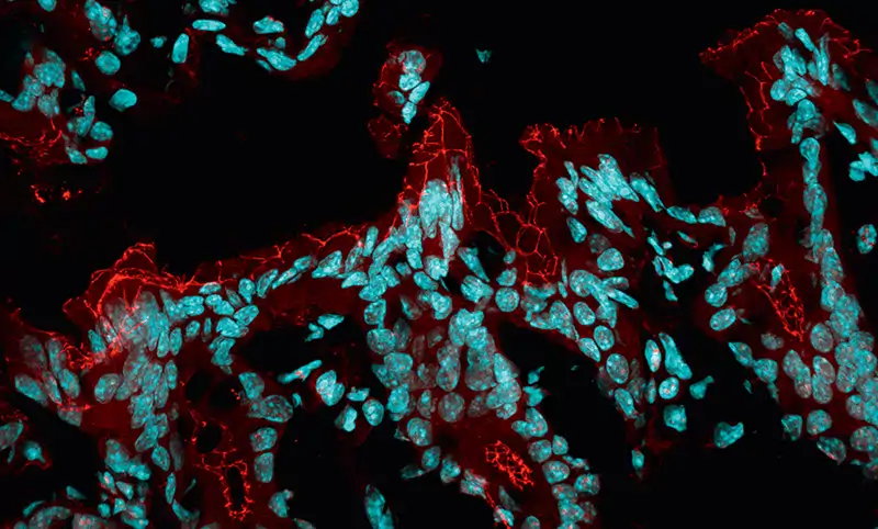 Imagen de la barrera intestinal