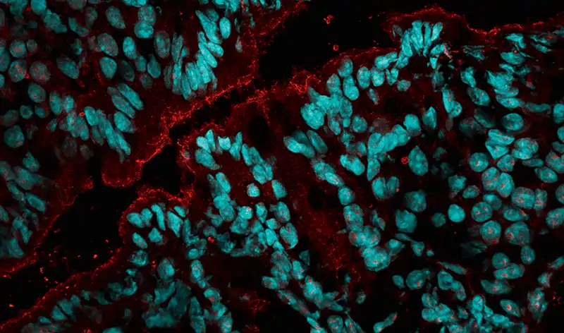 Imagen de la barrera intestinal