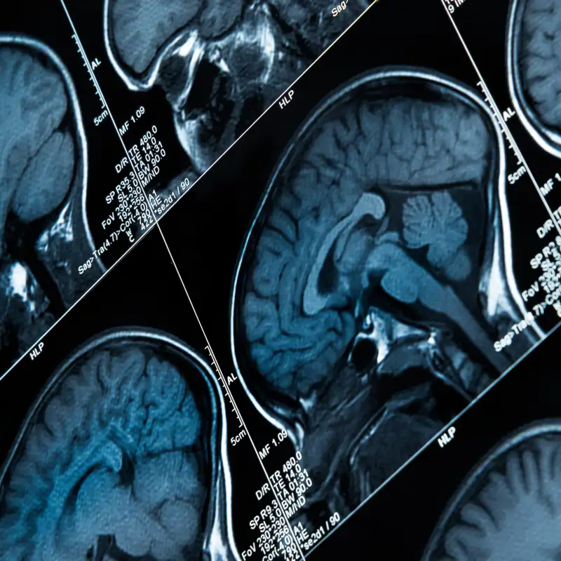 Sinestesia o por qué hay personas que 'escuchan' colores y 'ven' sonidos