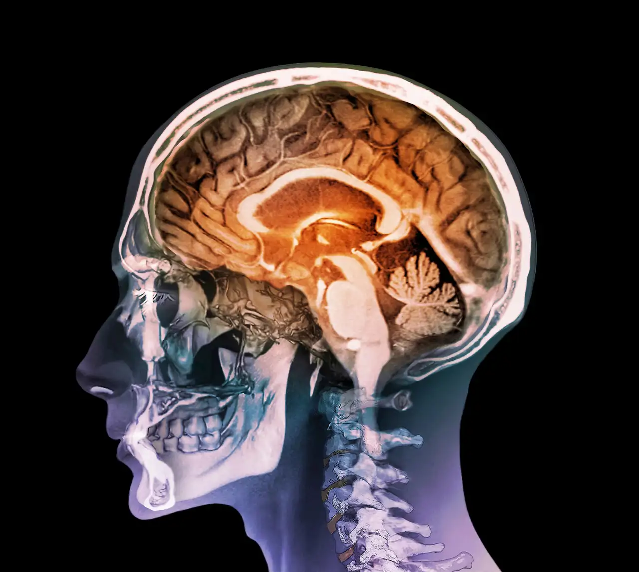 Cerebro humano