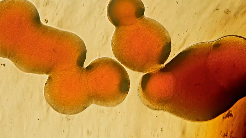 Bacterias de la especie "Altererythrobacter muriae"