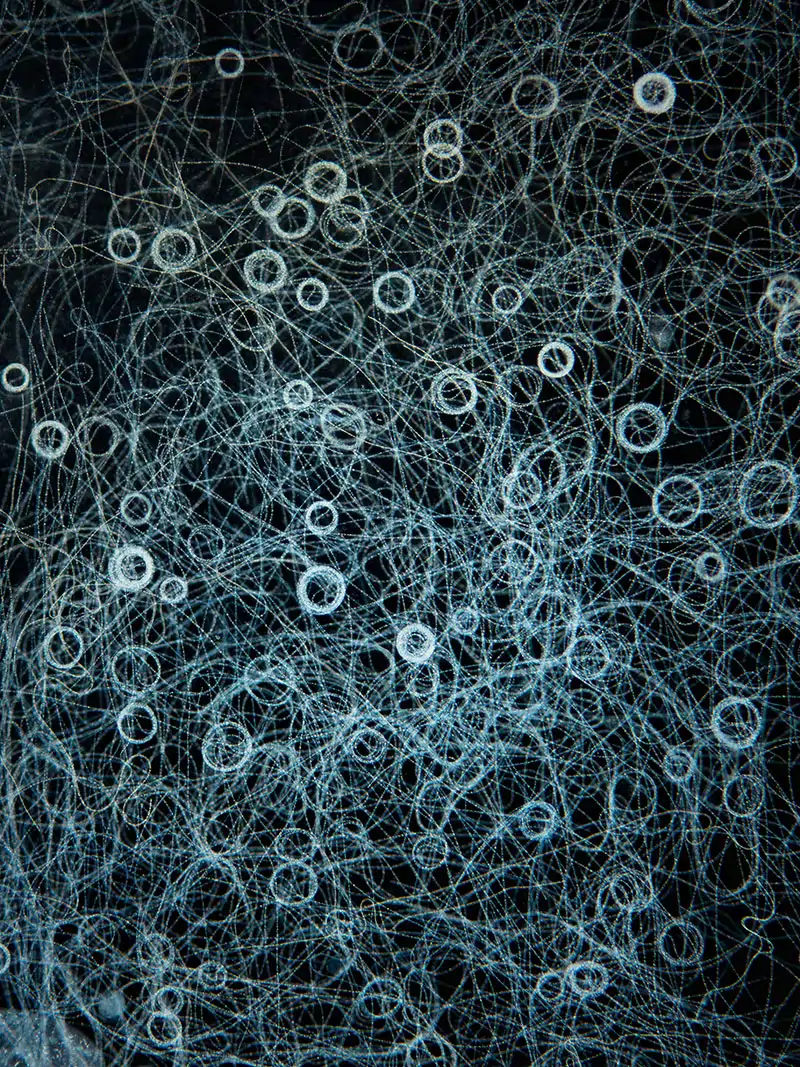 Ciliados del género "Carchesium "