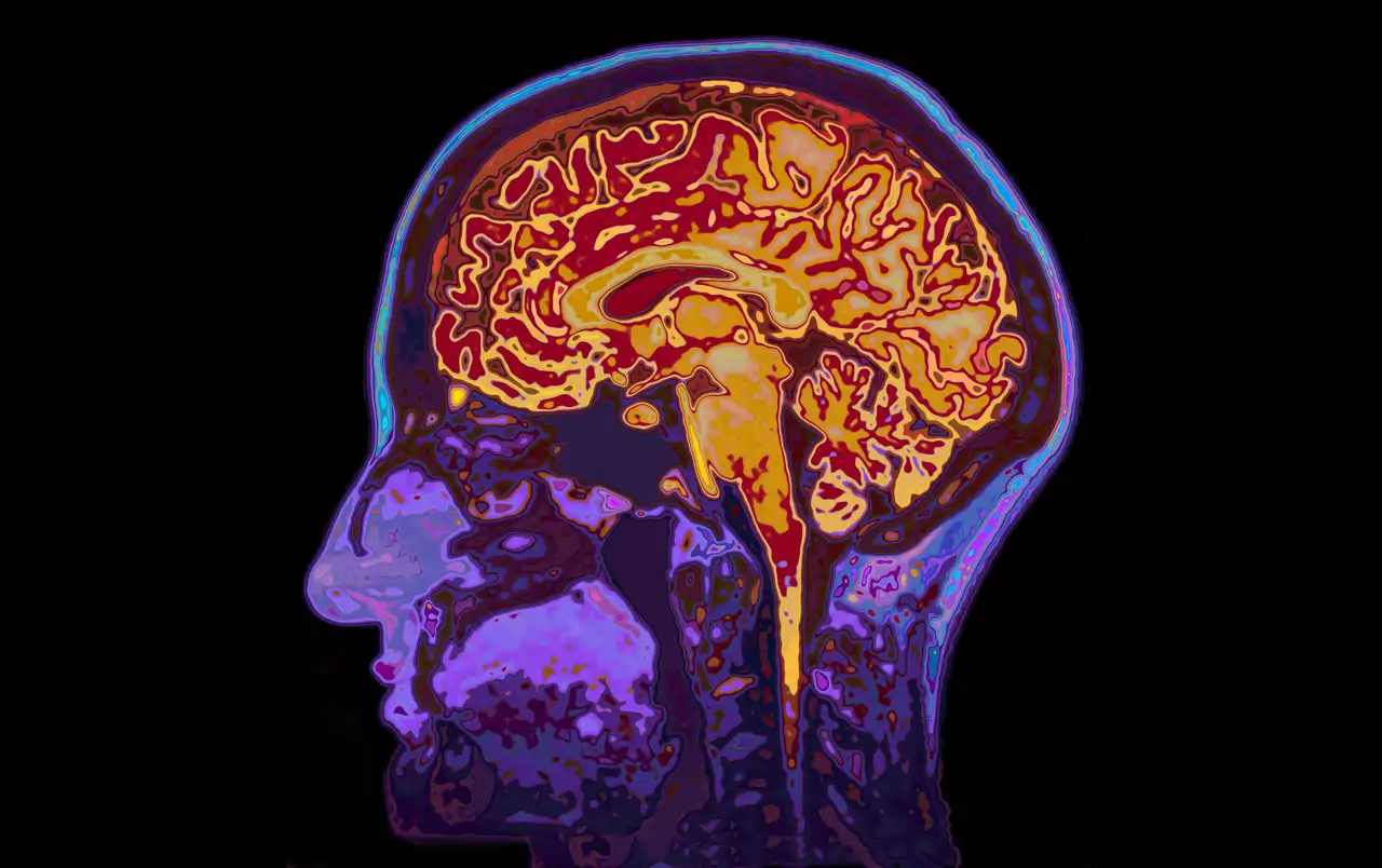Cerebro escáner