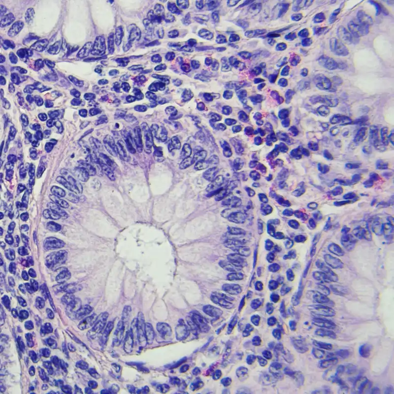 Consejos con base científica para prevenir el cáncer y reducir sus riesgos