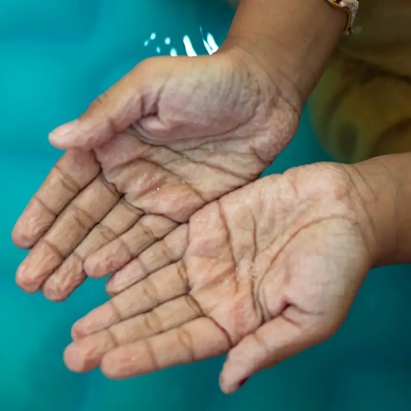 ¿Por qué se arrugan los dedos con el agua?